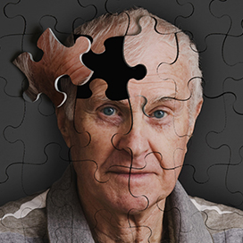 10 Facts about Alzheimer's disease you should know