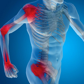 5 Hacks for reducing inflammation