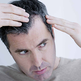 Your guide to hair loss treatments