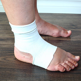 The Causes of Swollen Feet