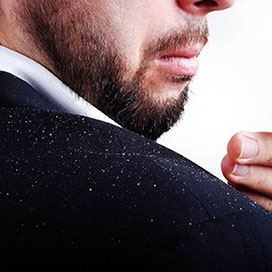 Dandruff Solutions for Men